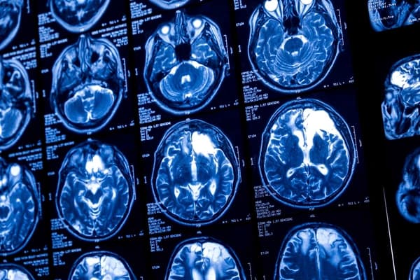 Radiology MIPS measures and quality measures guide for 2025